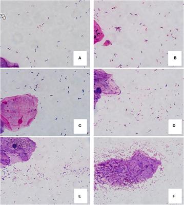 Effect of vaginal flora on clinical outcome of frozen embryo transfer